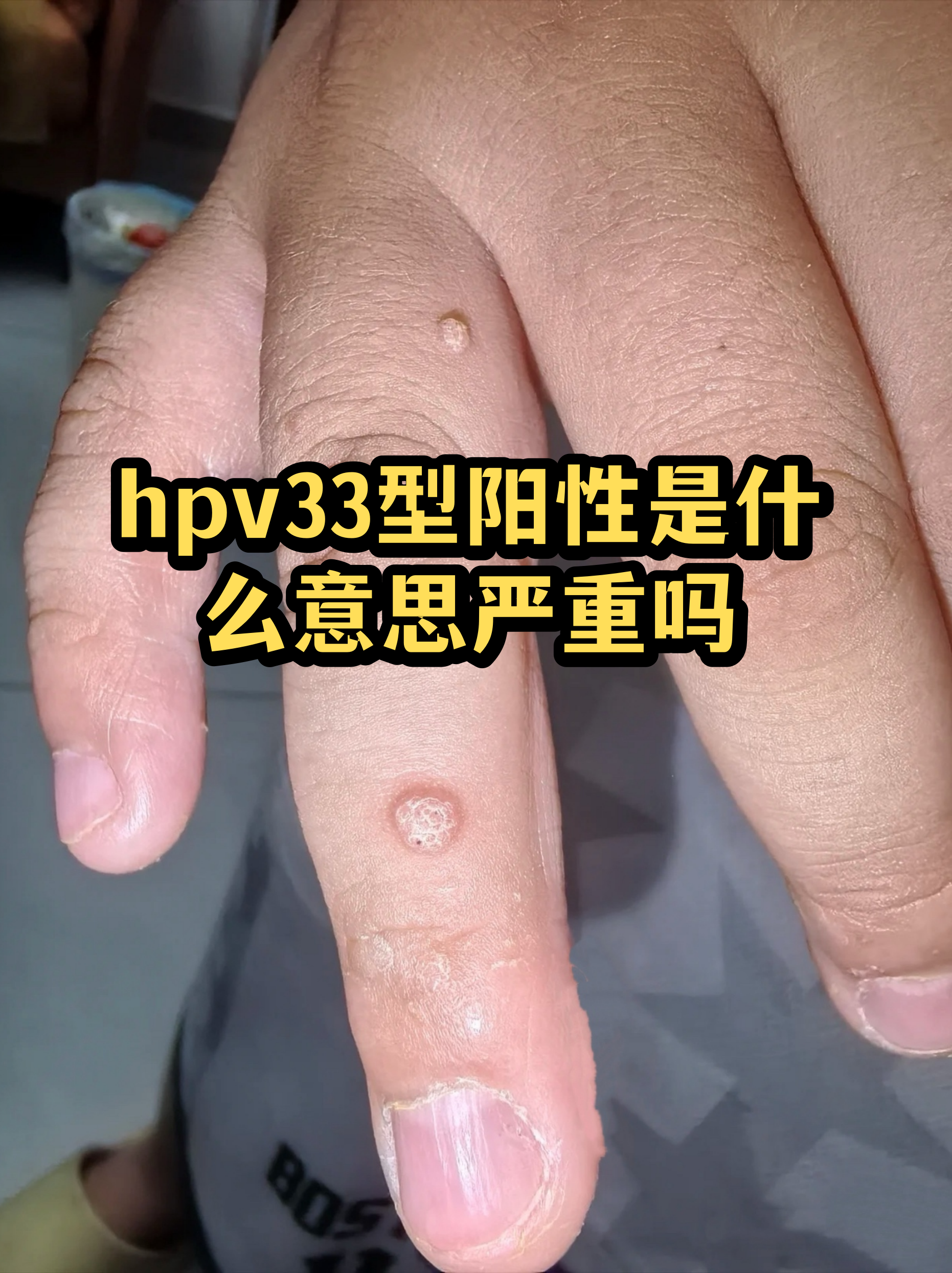 疫情新增,疫情 新增