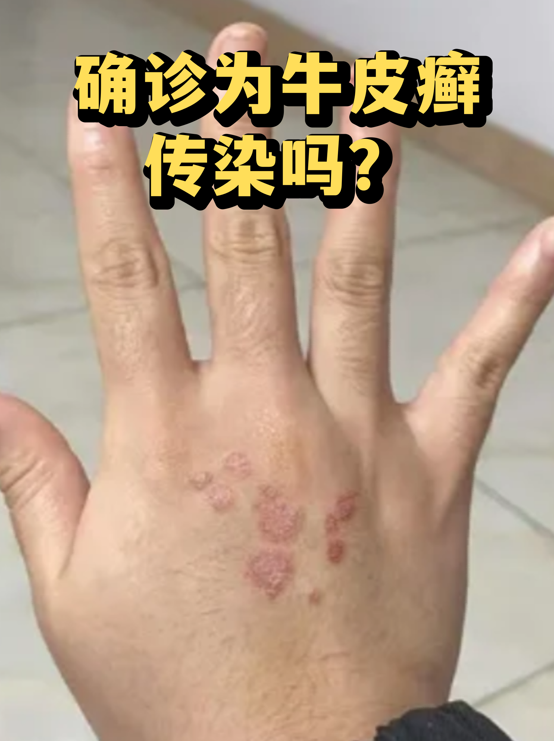 疫情新增︰(疫情 新增)-第3张图片