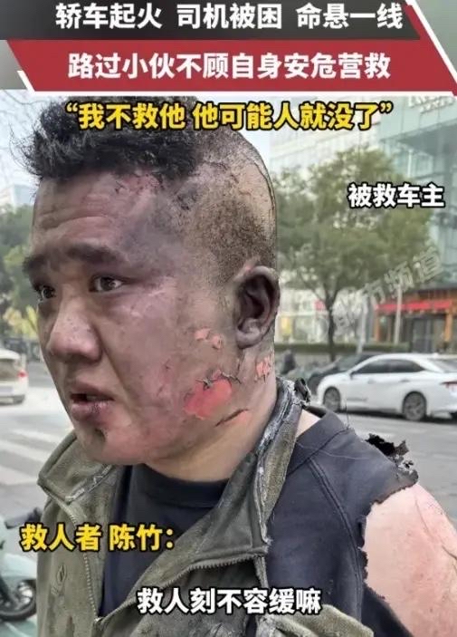 【警察死于疫情,疫情期间累死的警察】-第2张图片
