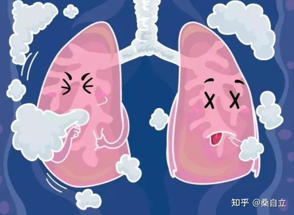 疫情算个啥/疫情是属于什么-第2张图片