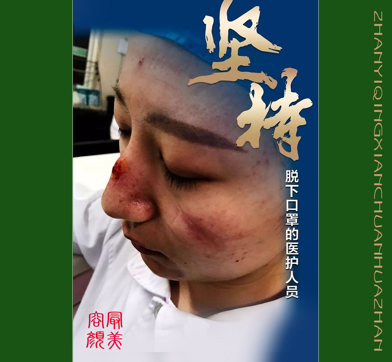 宣扬抗疫情(宣传抗疫情的话)-第2张图片