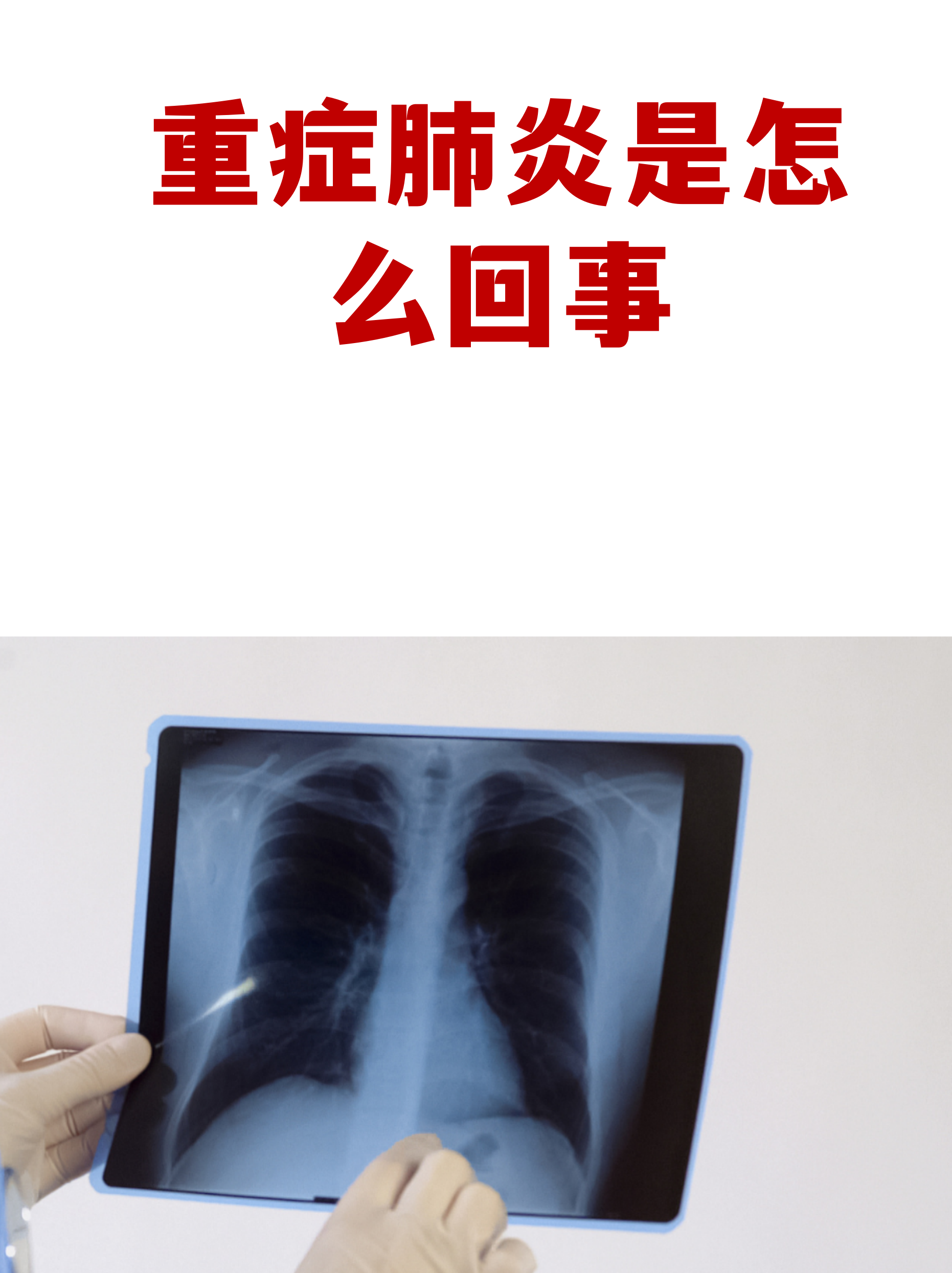 辽宁营口新增2例-辽宁营口新增一例肺炎患者-第2张图片