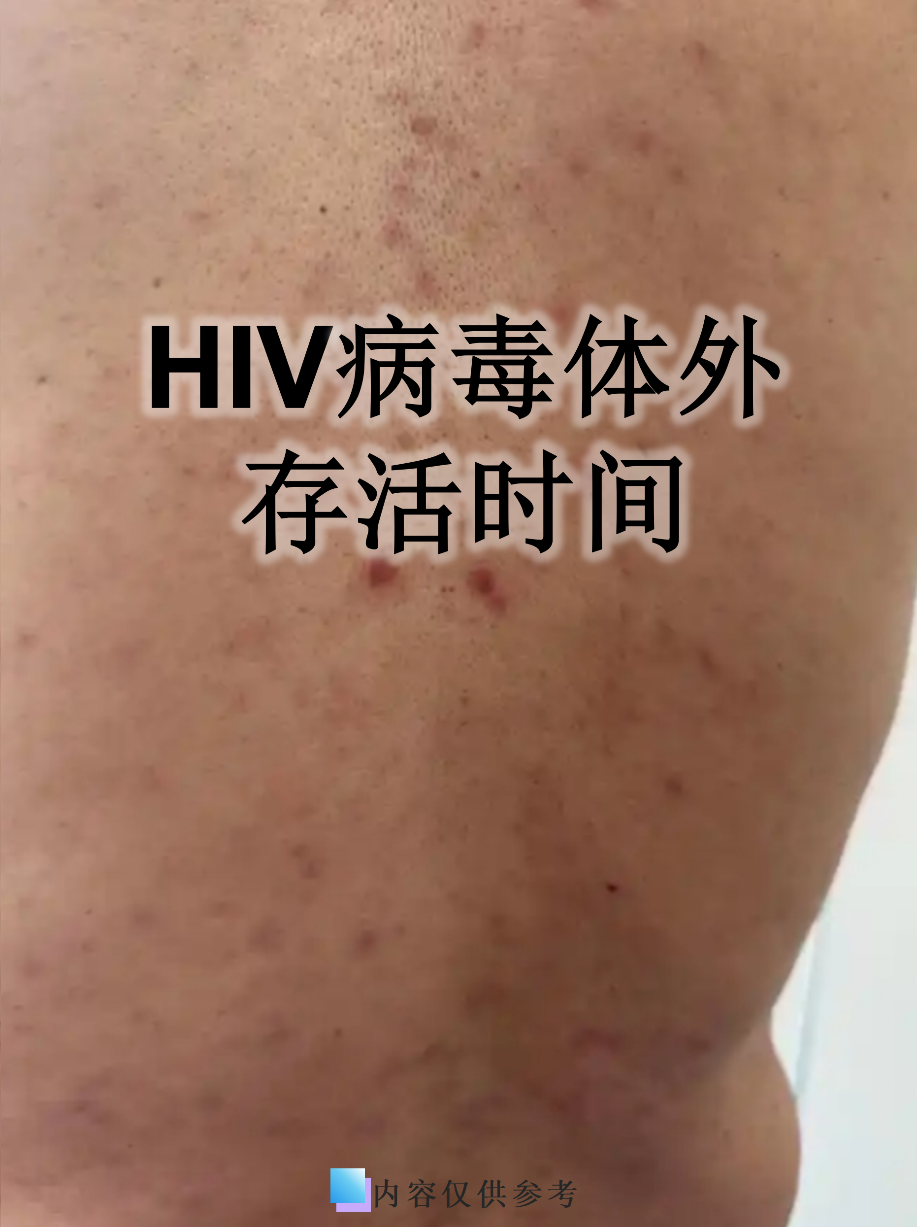 烟台发现1例无症状感染者〃烟台发现一例无症状感染者